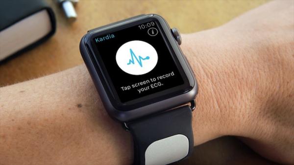 photo of Study Suggests AliveCor KardiaBand for Apple Watch Can Be Used With AI Algorithm to Detect High Potassium image