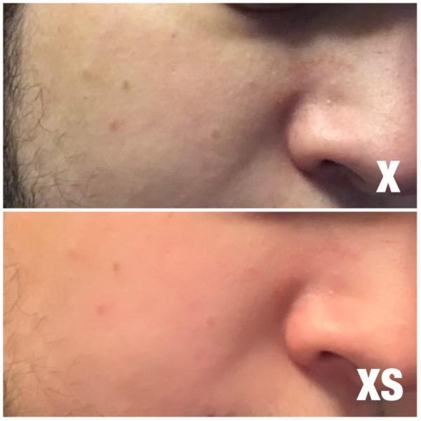 photo of iPhone XS Users Complain About Skin-Smoothing Selfie Camera image