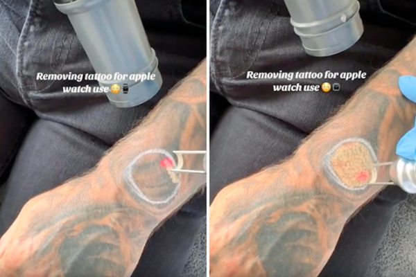 Man removes part of tattoo sleeve to…