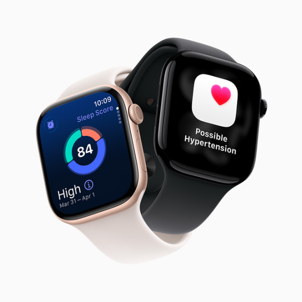 Apple Watch dominates Q1 2026…