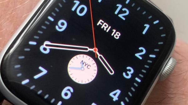 photo of Apple has made it clear how you should wear your Apple Watch image