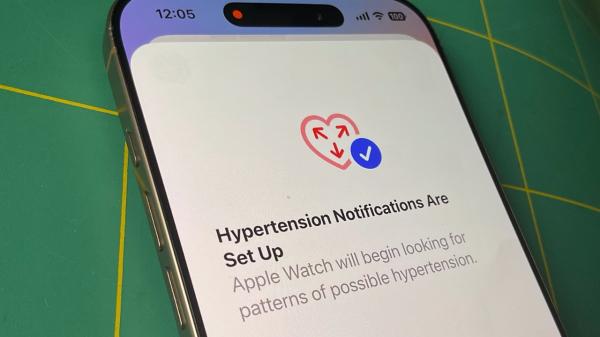 photo of How Apple Watch looks for hypertension and what do if you get an alert image