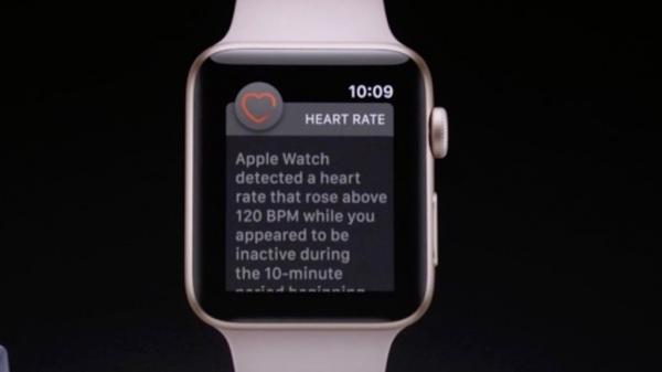 photo of Reddit user says Apple Watch saved his life helping detect supraventricular tachycardia image