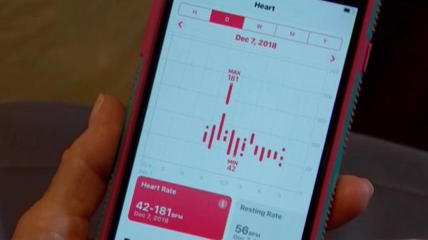 photo of Apple Watch detects A-fib in Texas woman, doctor says it greatly expedited diagnosis image